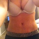looks like my boobs are crooked but its just how I am holding the camera. Hate the stretch marks but still happy with results.