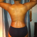 Post op back, lower back and arms - 4 weeks