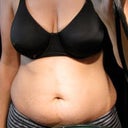 Before photo of stomach and breast