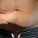 Before photo, yep... I could pinch several inches. You should have seen it in a sitting position. My belly button is shaped like an eye.