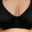 Before photo of breast. Can tell from cleavage that they droop. Skin on breast were wrinkled and loose too. This looks better than actually is due to under wire.