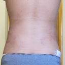 1 week after
