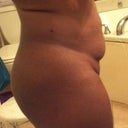 before- side abdominal area