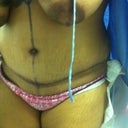 My 1st dr appt 6 days post op