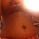 16 days post op