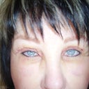 Day 6 after taking Prednisolone