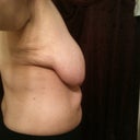 Pre-Op