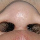 After, Straight-Up View