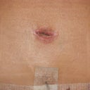 2 weeks-Belly button up close