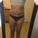 Front 1 mo post ---- Can anyone notice a difference?