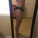 Left Side 1 mo post