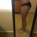 Right Side 1 mo post