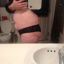 Pre-surgery