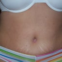 6wks post