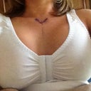 My breasts 3 days PO.  Still very high.  Can't wait to see the final result :)