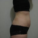 3 weeks after