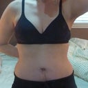 Front view 6 weeks post