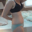 Side view six weeks post