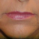 Before Juvederm..and lots of makeup!