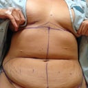 Drawings right before surgery