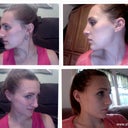 Comparison shots (Day of cast removal shots)