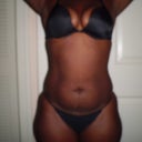 before front view