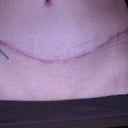 12 weeks.