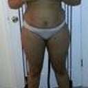 Pre-op front