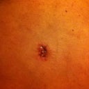 4 wks post-op.  BB is still oozing goo and blood.