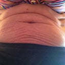 Loose skin. Courtesy of my boys.  Love them!