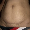 before w/ the bikini I'm hoping to wear after : )