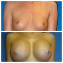 Before and after
