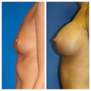 Before and after