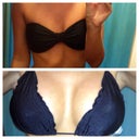 Bikini Before and after