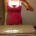 3 days post op.