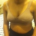 Post op Day 1 a bit bloated :/ and cant remove surgical bra until Wednesday