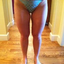 11 weeks post op