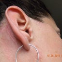 This is what the scar looks like behind my ear.  I can't ware sunglasses for very long before it really starts to hurt.  This is Oct. 28,2010 almost one year out.