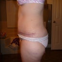 3 weeks side view