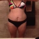 after @ 12 days post surgery