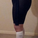 2 days post op ... very swollen ;/