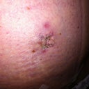 belly button at 3 weeks...yuck :(