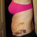left side is way more bruised!!