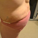 left side 8 dpo