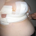 Right side.....belly is crazy!!