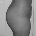 12 day post op