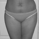 12 day post op