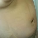 POD 5 MORE swollen, now looking prego. was really dicouraged ..this is mid afternoon after a shower