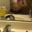 POD8 after shower, swelling gradually seemed to be going down, bikini photo op..still not satisfied