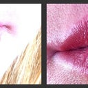 before and after